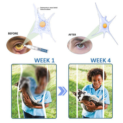 Ourlyard™  PureVision Clear Relief Eye Drops🌿💧Only Preservative-Free Drop ✅ Approved and recommended by the 🏥 AAO (American Academy of Ophthalmology) team and 🔬 FDA certified.