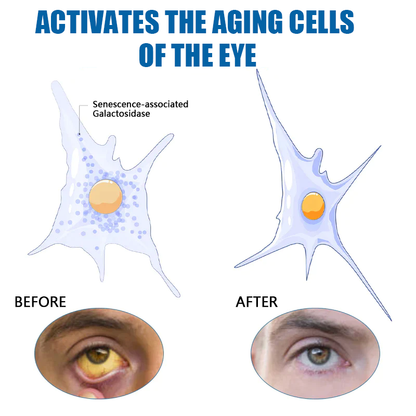 Ourlyard™ Eye drops for treating vision issues